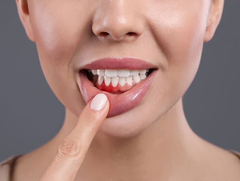 Gum disease treatment illustration